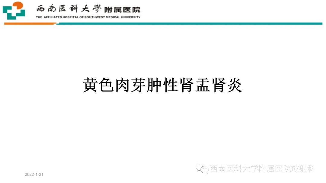 影像PPT - 【PPT】黄色肉芽肿性肾盂肾炎-12