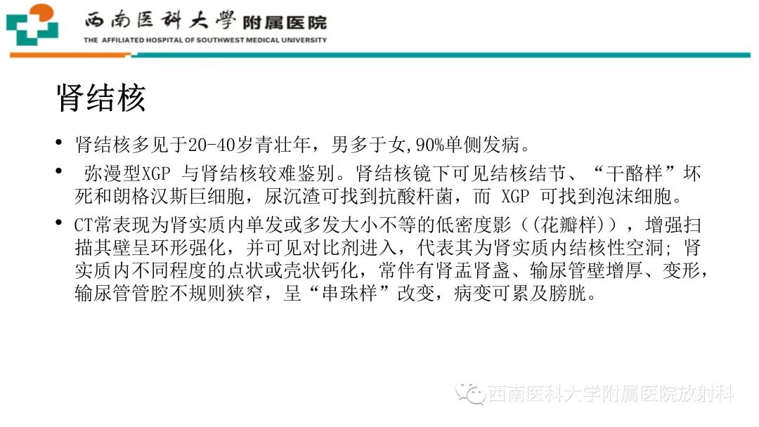 影像PPT - 【PPT】黄色肉芽肿性肾盂肾炎-23