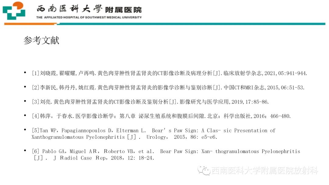 影像PPT - 【PPT】黄色肉芽肿性肾盂肾炎-32