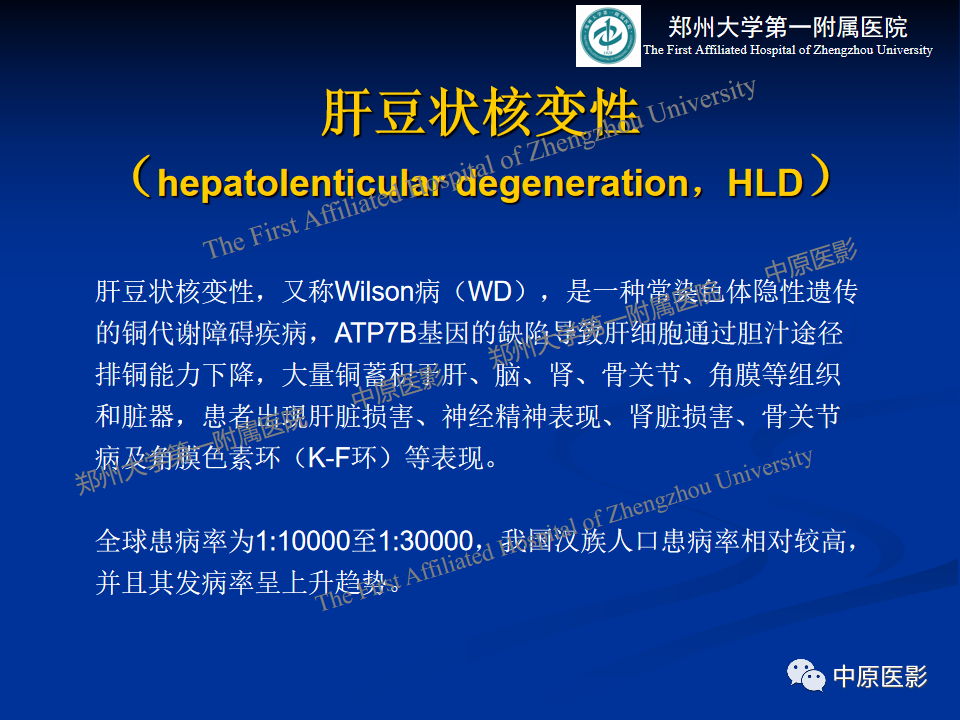 影像PPT - 【病例】肝豆状核变性1例MR影像表现-9