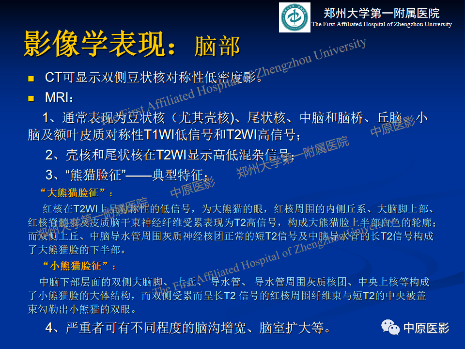影像PPT - 【病例】肝豆状核变性1例MR影像表现-19