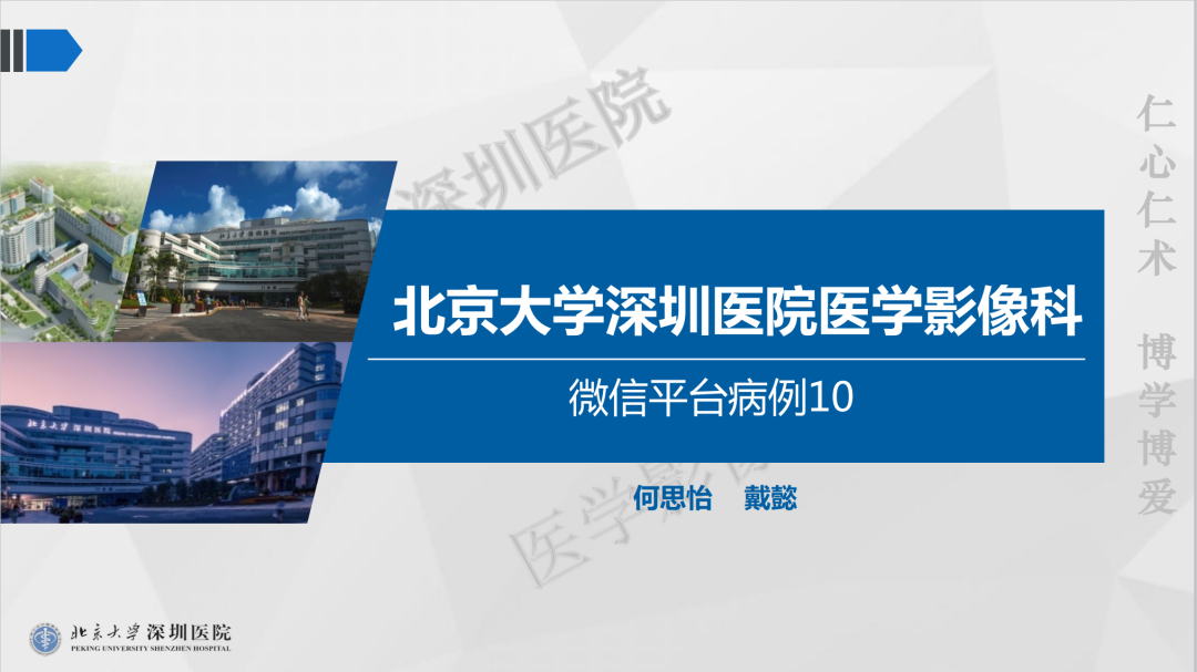 影像PPT - 【PPT】胰腺实性假乳头状瘤-1