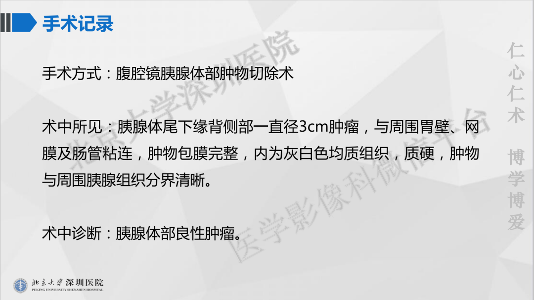 影像PPT - 【PPT】胰腺实性假乳头状瘤-9