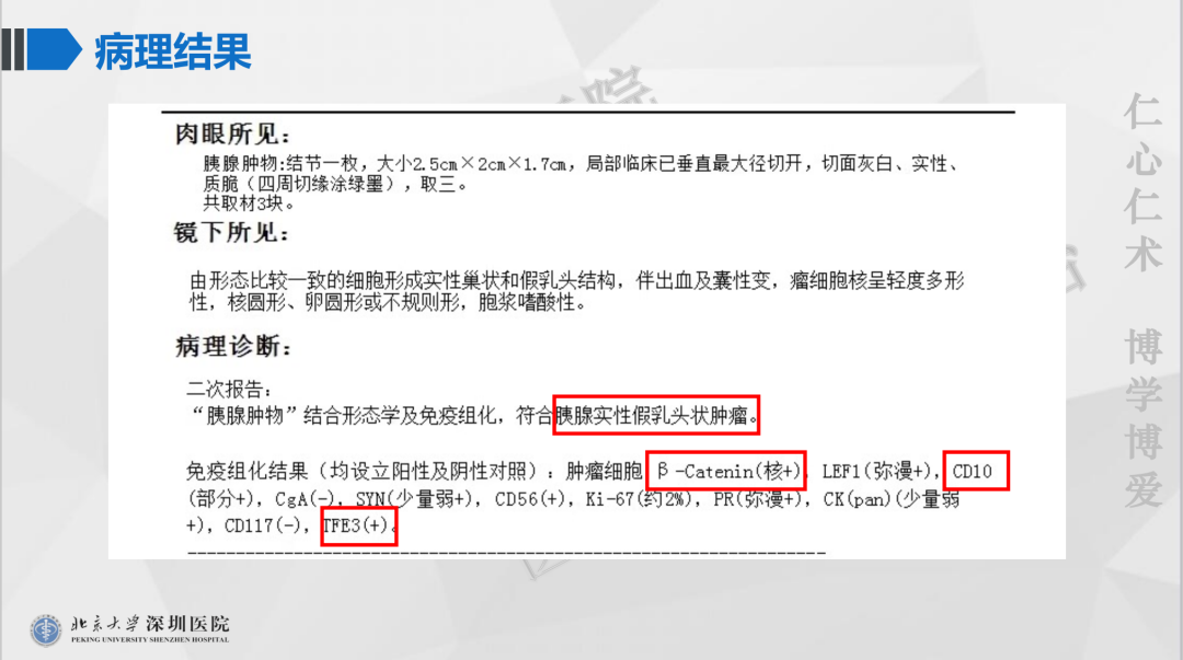 影像PPT - 【PPT】胰腺实性假乳头状瘤-10