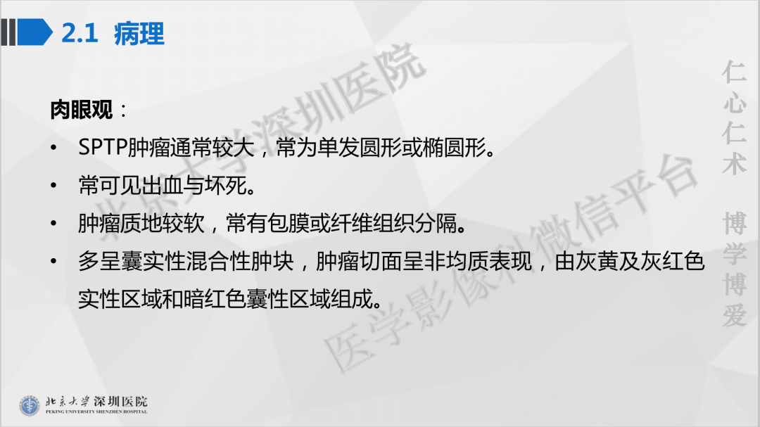 影像PPT - 【PPT】胰腺实性假乳头状瘤-16