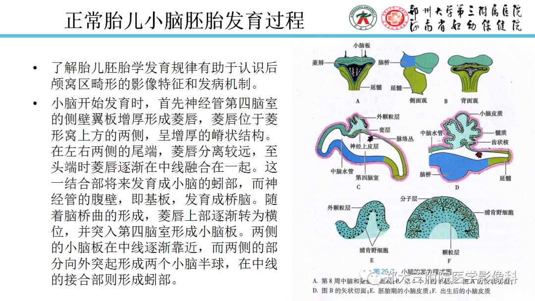 影像PPT - 【PPT】正常胎儿小脑胚胎发育及常见疾病异常发育过程-2