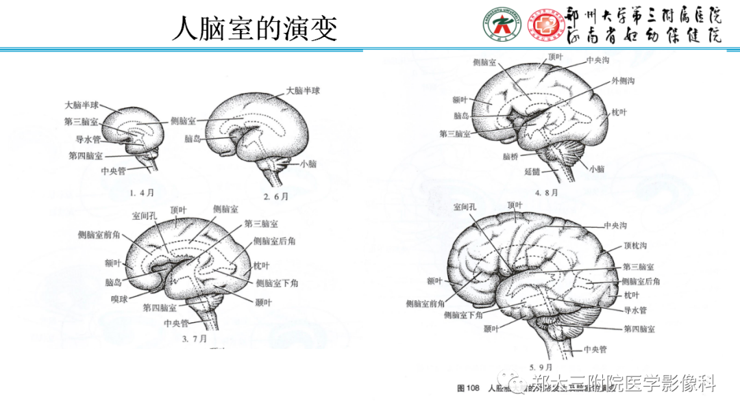 影像PPT - 【PPT】正常胎儿小脑胚胎发育及常见疾病异常发育过程-8
