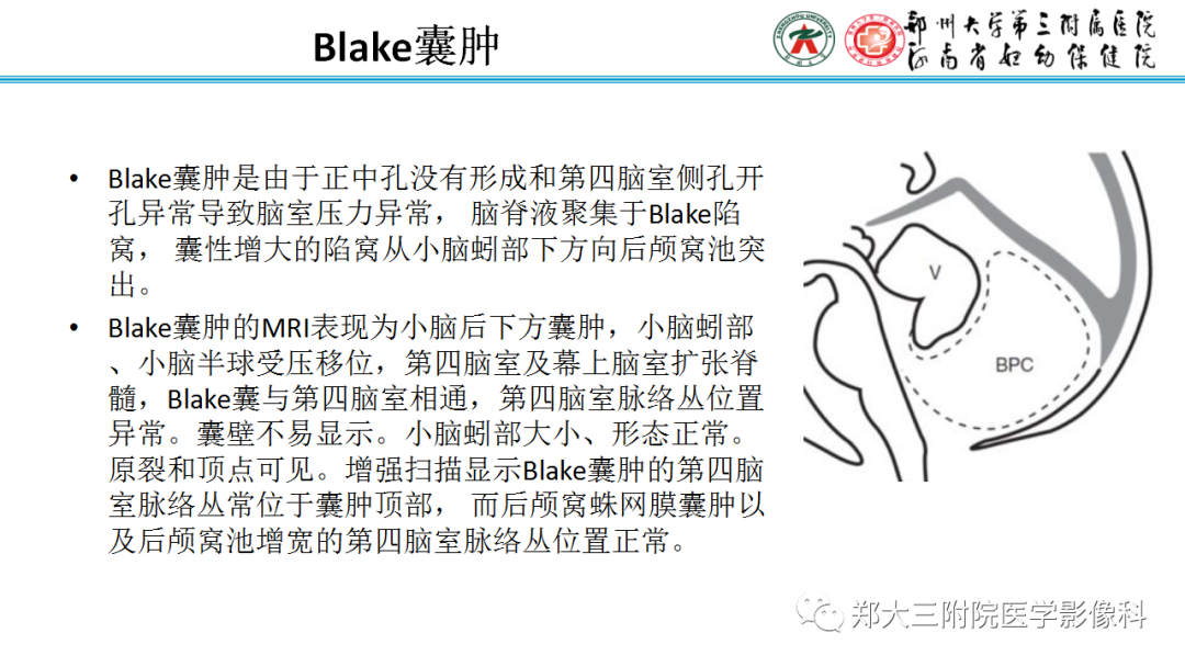影像PPT - 【PPT】正常胎儿小脑胚胎发育及常见疾病异常发育过程-12