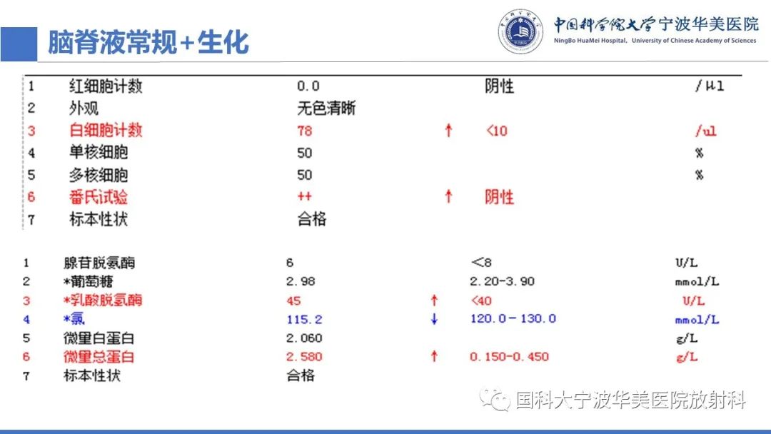 影像PPT - 【PPT】颅内结核-5