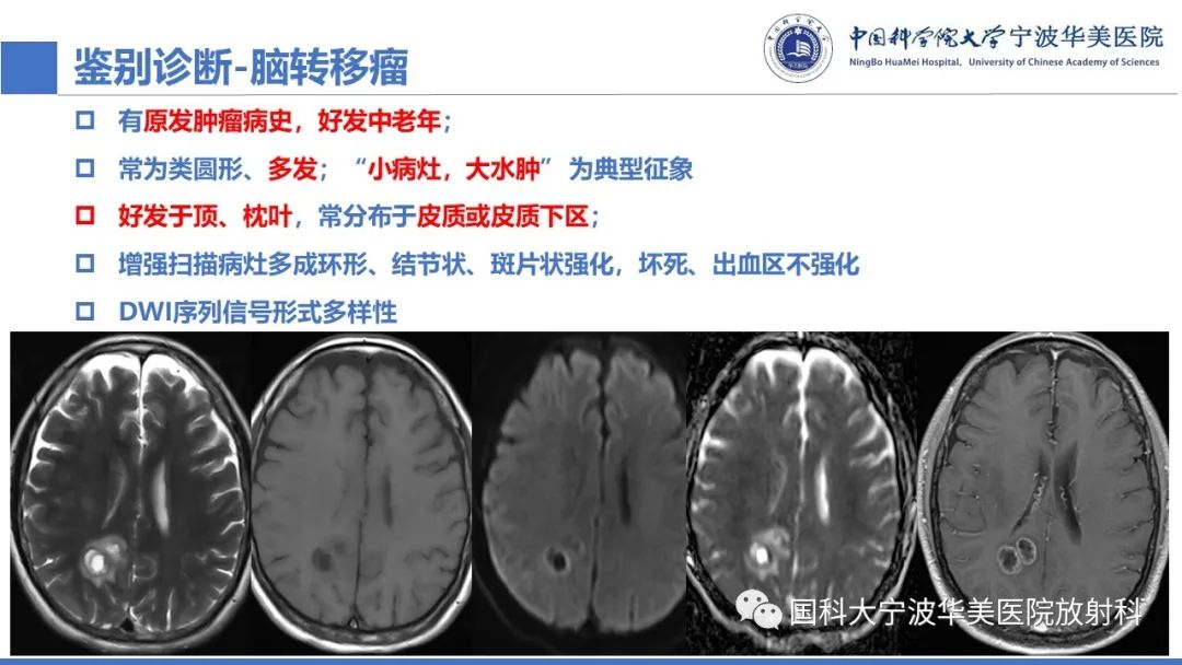 影像PPT - 【PPT】颅内结核-46