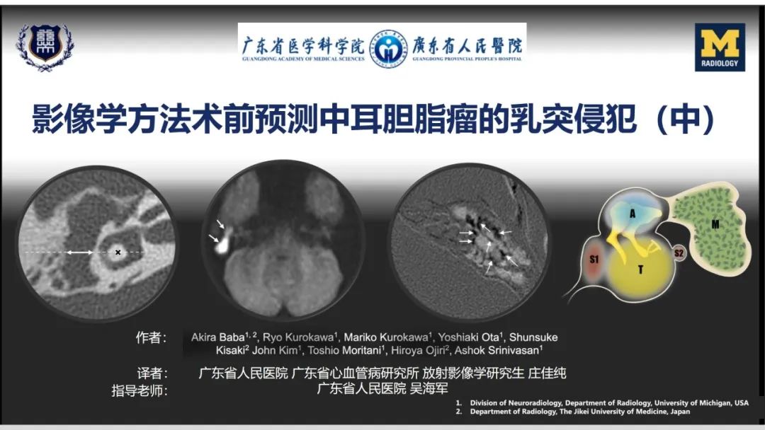影像PPT - 【PPT】影像学方法术前预测中耳胆脂瘤的乳突侵犯-1