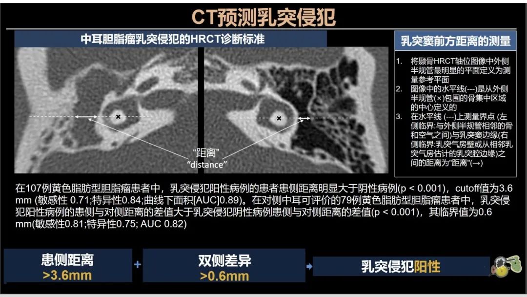 影像PPT - 【PPT】影像学方法术前预测中耳胆脂瘤的乳突侵犯-5
