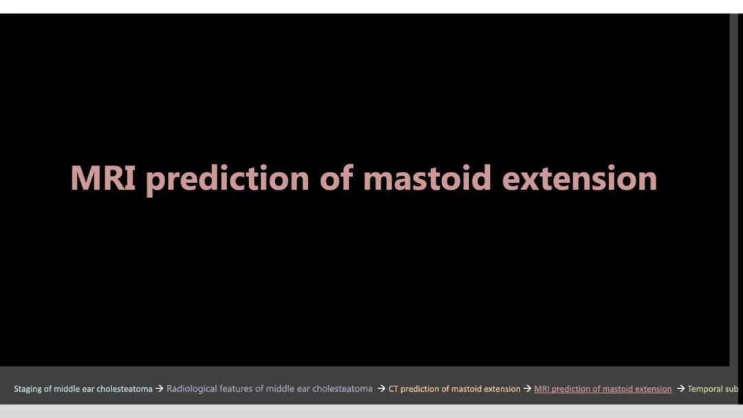 影像PPT - 【PPT】影像学方法术前预测中耳胆脂瘤的乳突侵犯-14
