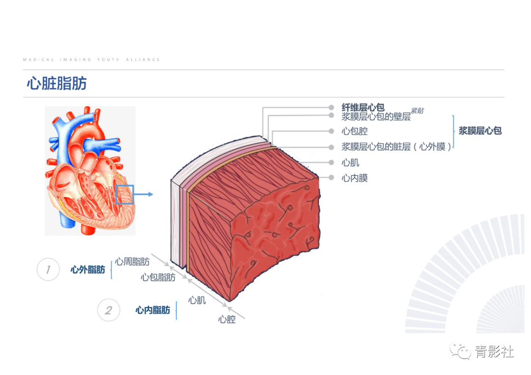 影像PPT - 【PPT】心脏脂肪临床意义和分析思路-2