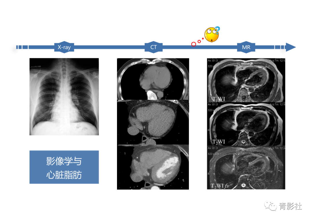 影像PPT - 【PPT】心脏脂肪临床意义和分析思路-3