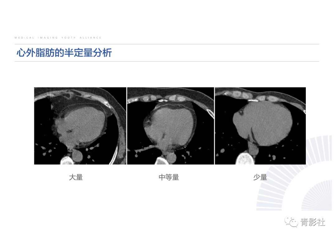 影像PPT - 【PPT】心脏脂肪临床意义和分析思路-6