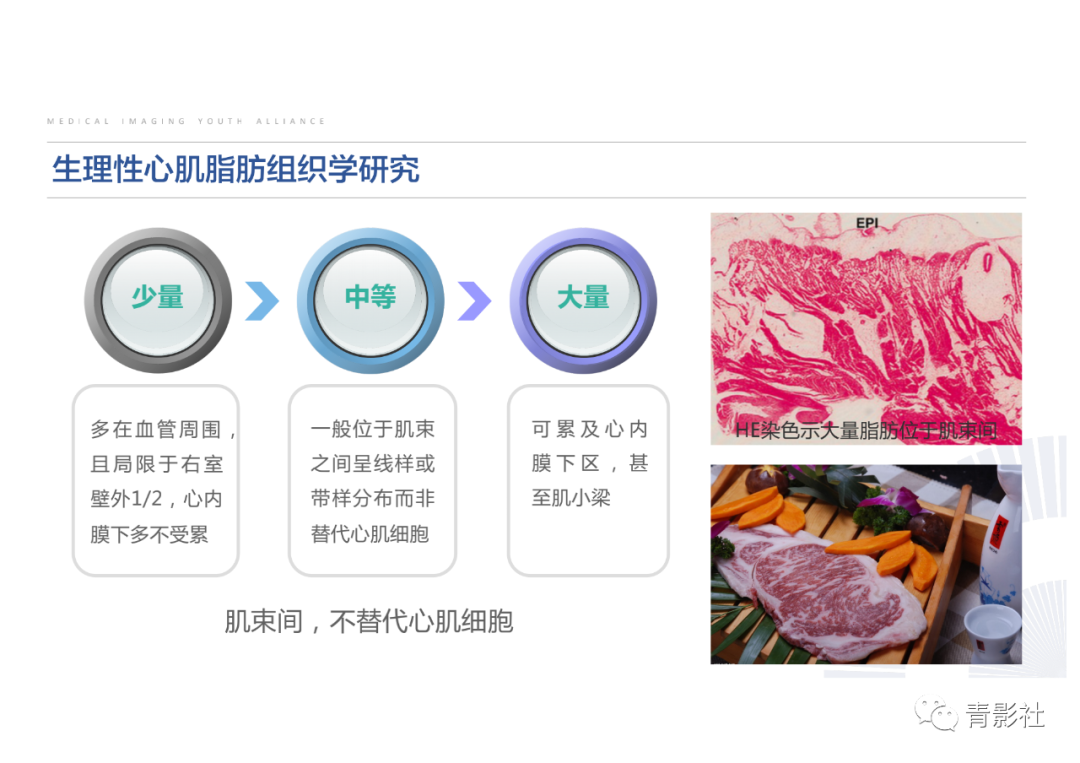 影像PPT - 【PPT】心脏脂肪临床意义和分析思路-13