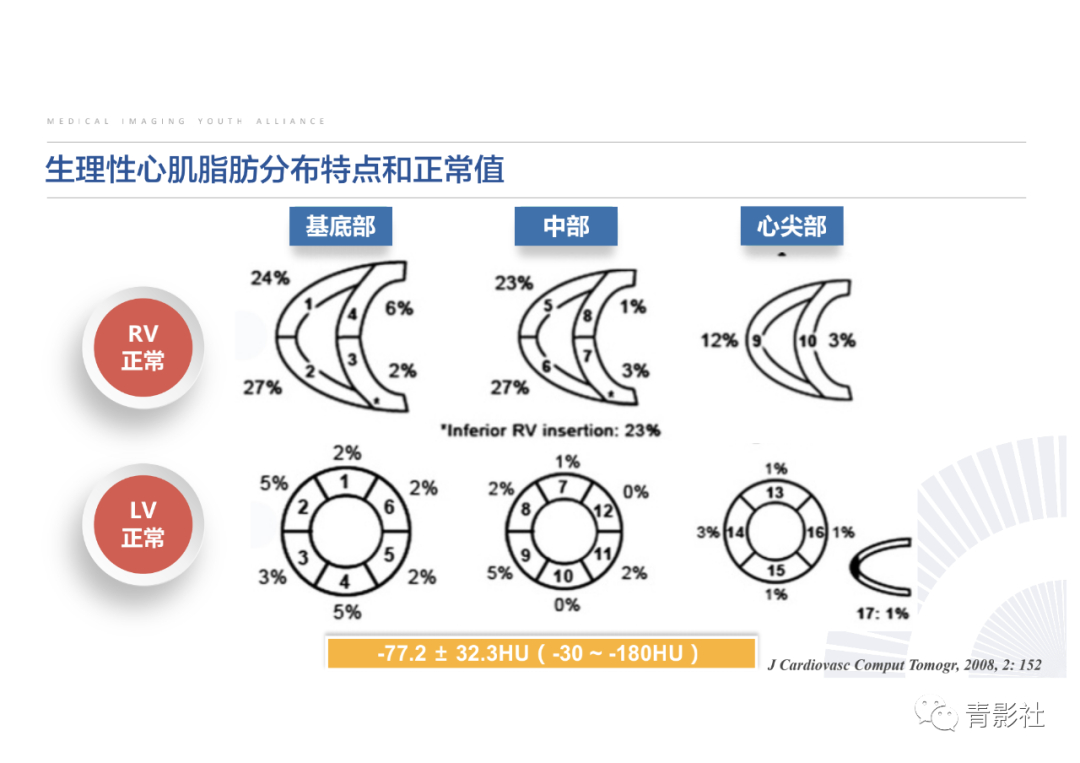 影像PPT - 【PPT】心脏脂肪临床意义和分析思路-14