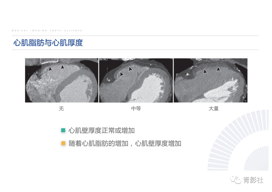 影像PPT - 【PPT】心脏脂肪临床意义和分析思路-16