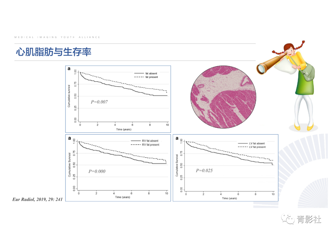 影像PPT - 【PPT】心脏脂肪临床意义和分析思路-17