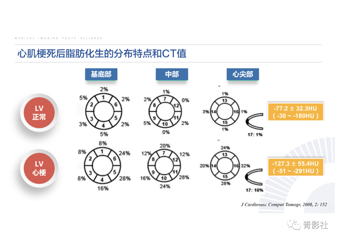 影像PPT - 【PPT】心脏脂肪临床意义和分析思路-19