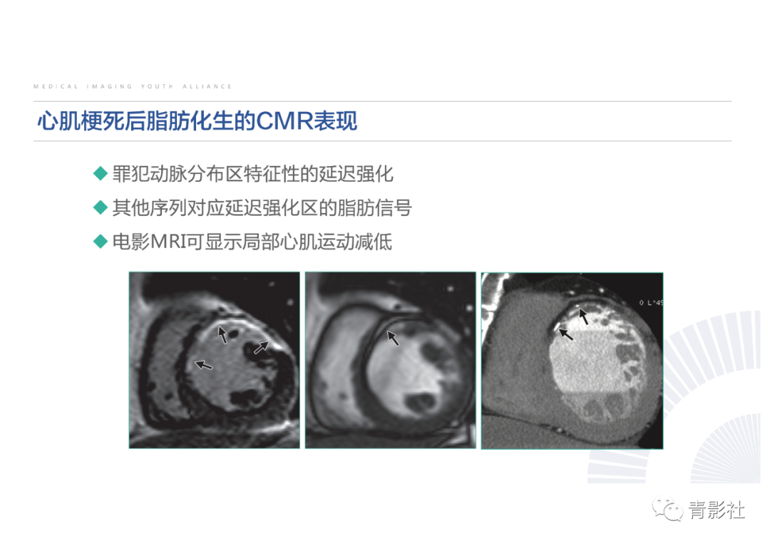 影像PPT - 【PPT】心脏脂肪临床意义和分析思路-22
