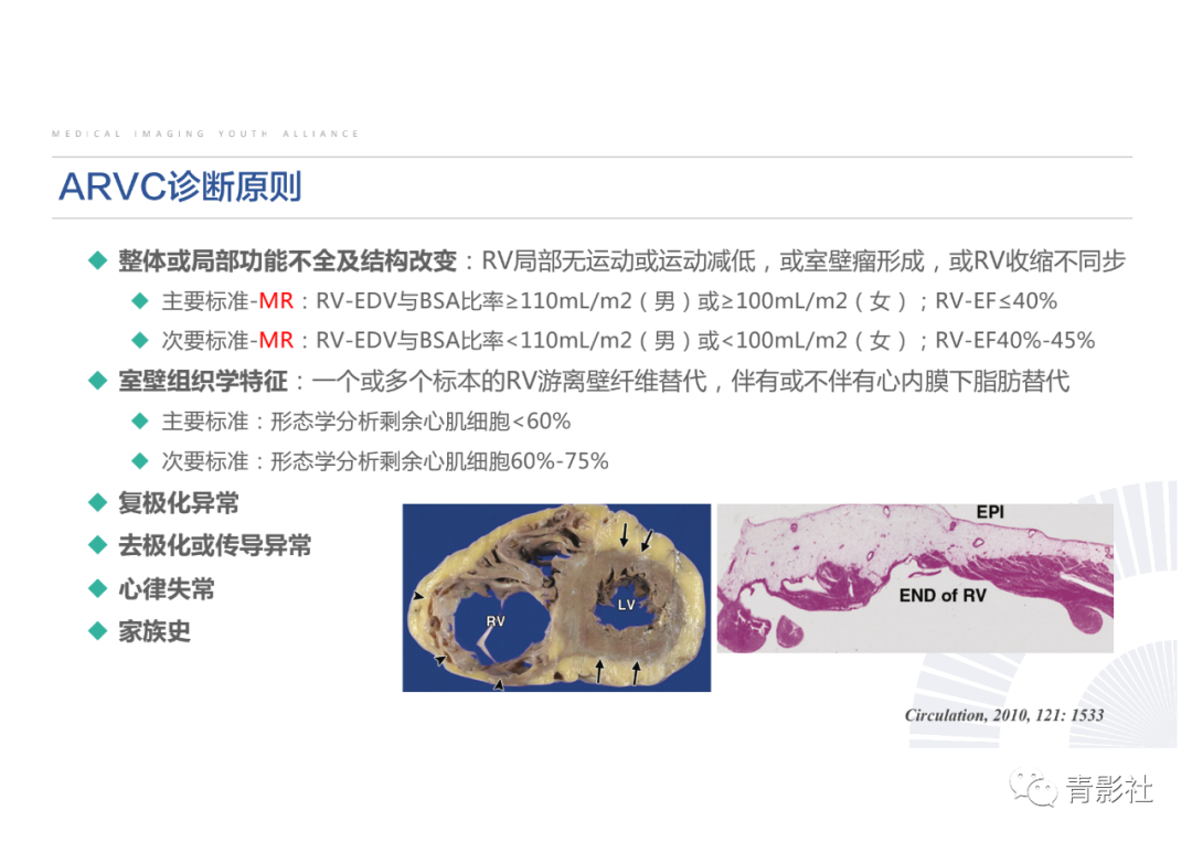影像PPT - 【PPT】心脏脂肪临床意义和分析思路-26