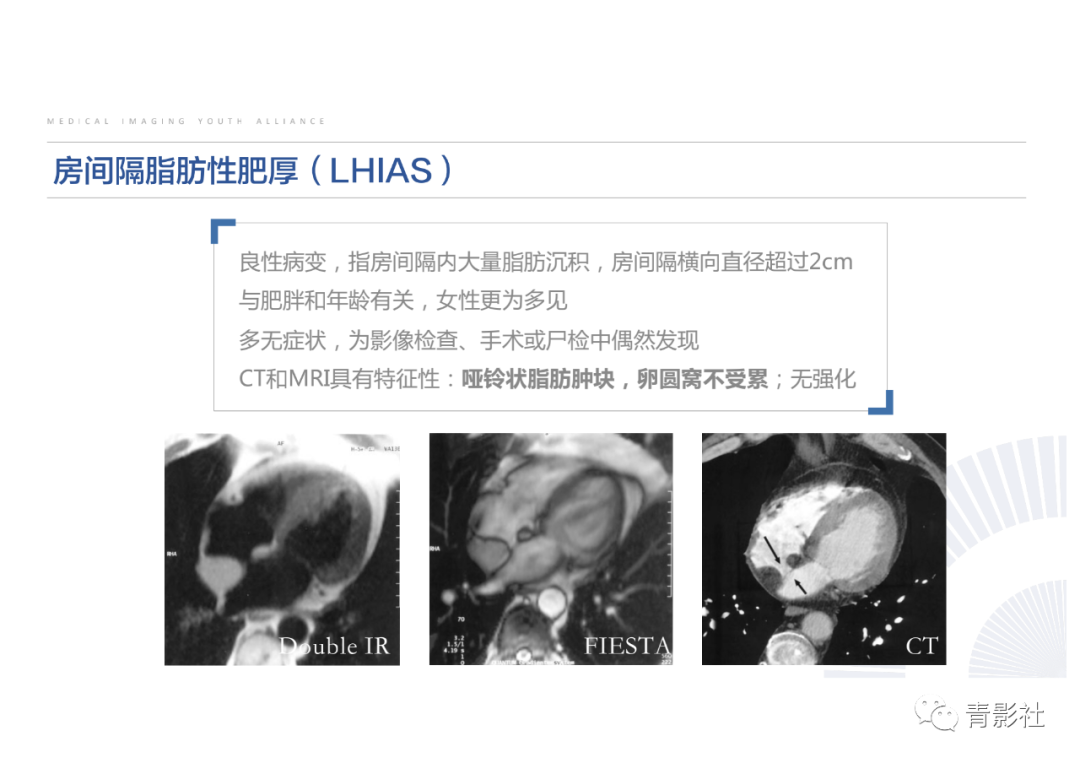 影像PPT - 【PPT】心脏脂肪临床意义和分析思路-30