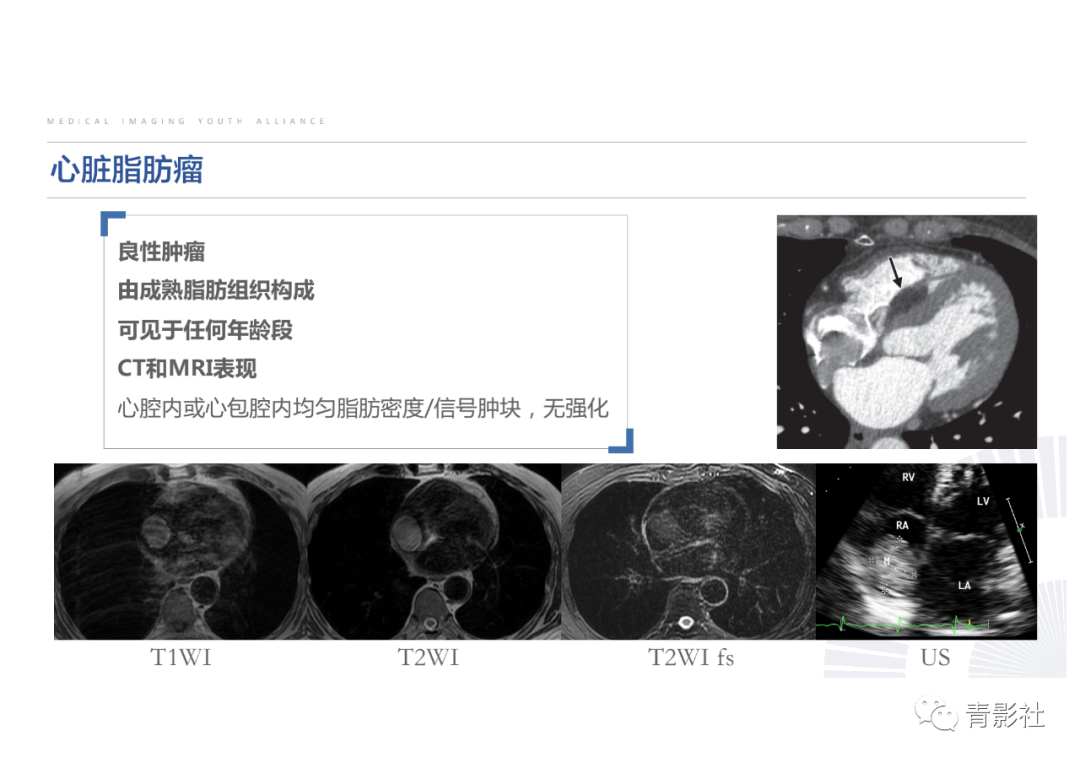 影像PPT - 【PPT】心脏脂肪临床意义和分析思路-31