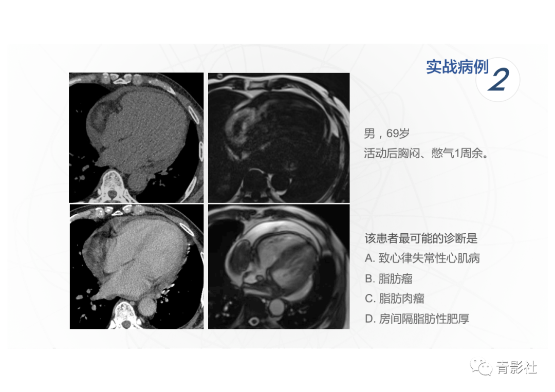影像PPT - 【PPT】心脏脂肪临床意义和分析思路-34