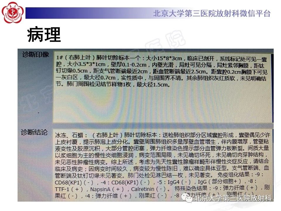 影像PPT - 【PPT】先天性肺囊性腺瘤样畸形-5