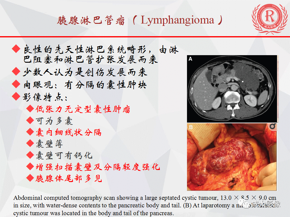 影像PPT - 【PPT】胰腺良性间叶源性肿瘤影像诊断-7