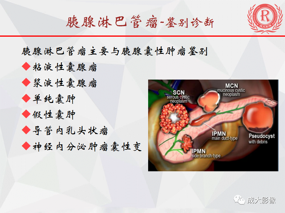 影像PPT - 【PPT】胰腺良性间叶源性肿瘤影像诊断-12