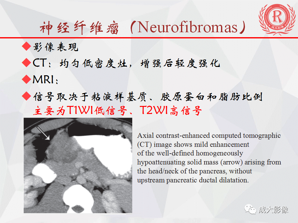 影像PPT - 【PPT】胰腺良性间叶源性肿瘤影像诊断-24