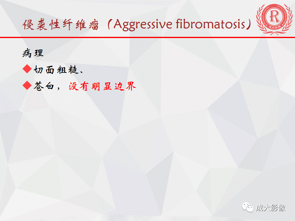 影像PPT - 【PPT】胰腺良性间叶源性肿瘤影像诊断-40