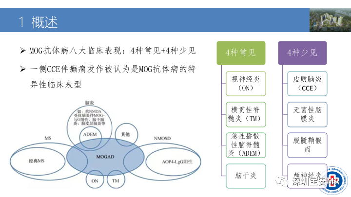 影像PPT - 【PPT】MOG抗体阳性单侧皮质脑炎的影像诊断及鉴别诊断-3