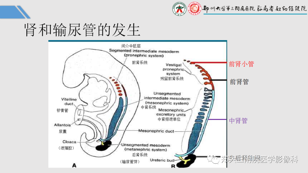 影像PPT - 【PPT】胎儿泌尿生殖系统常见疾病的MRI诊断-5
