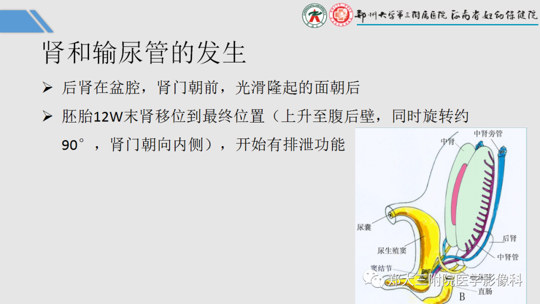 影像PPT - 【PPT】胎儿泌尿生殖系统常见疾病的MRI诊断-6