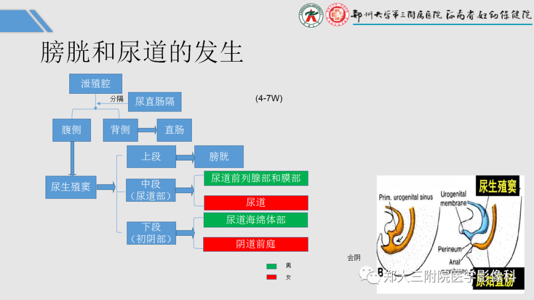 影像PPT - 【PPT】胎儿泌尿生殖系统常见疾病的MRI诊断-7