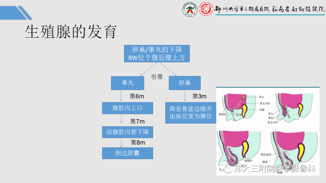 影像PPT - 【PPT】胎儿泌尿生殖系统常见疾病的MRI诊断-9