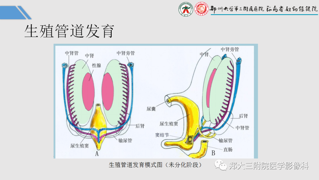 影像PPT - 【PPT】胎儿泌尿生殖系统常见疾病的MRI诊断-11