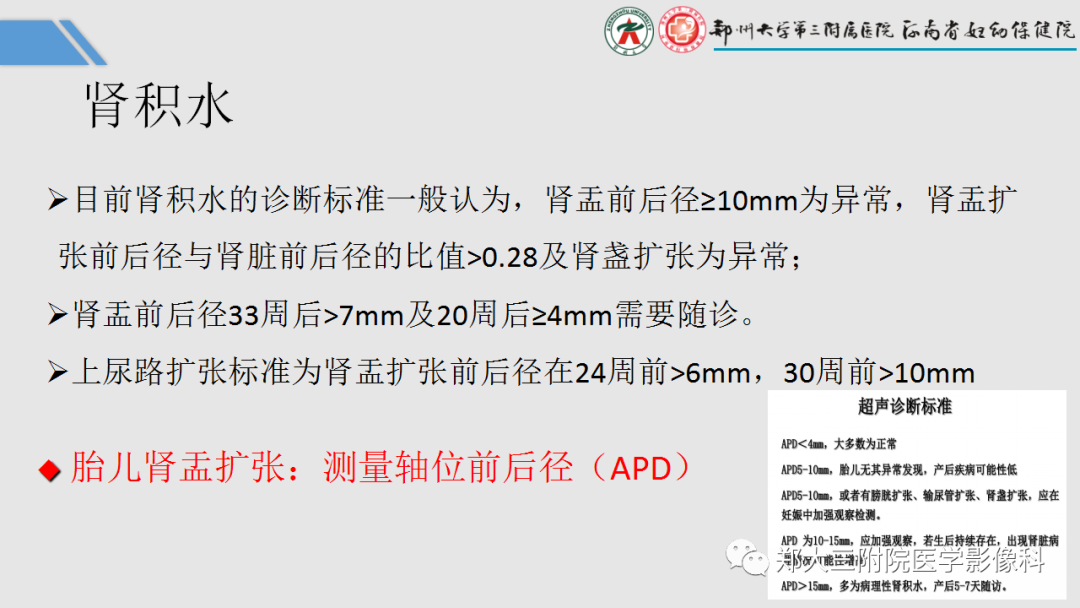 影像PPT - 【PPT】胎儿泌尿生殖系统常见疾病的MRI诊断-14