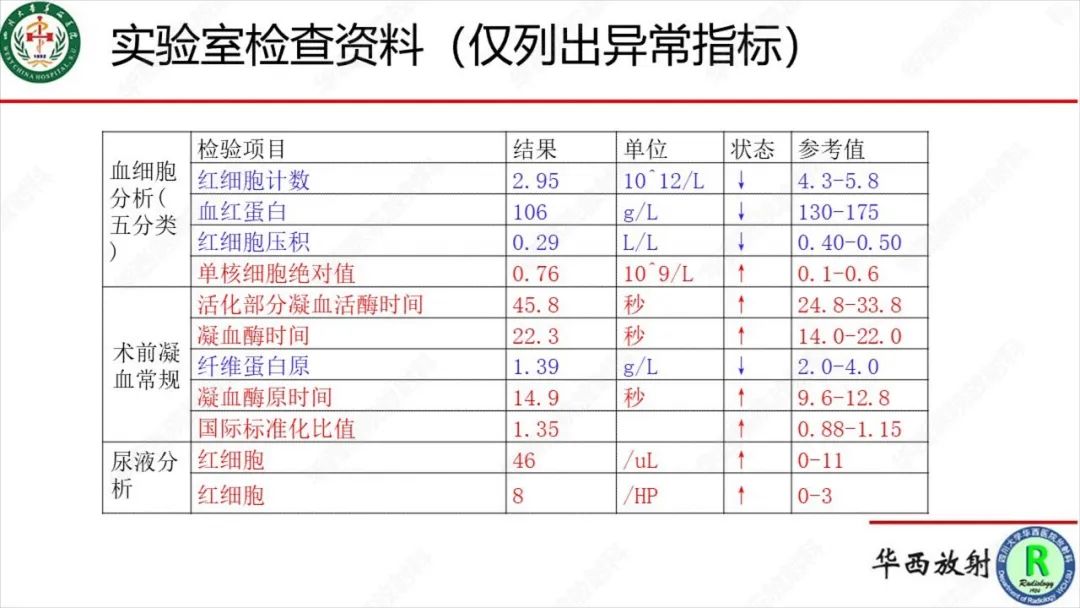 影像PPT - 【病例】肾脏滑膜肉瘤1例MR影像-2