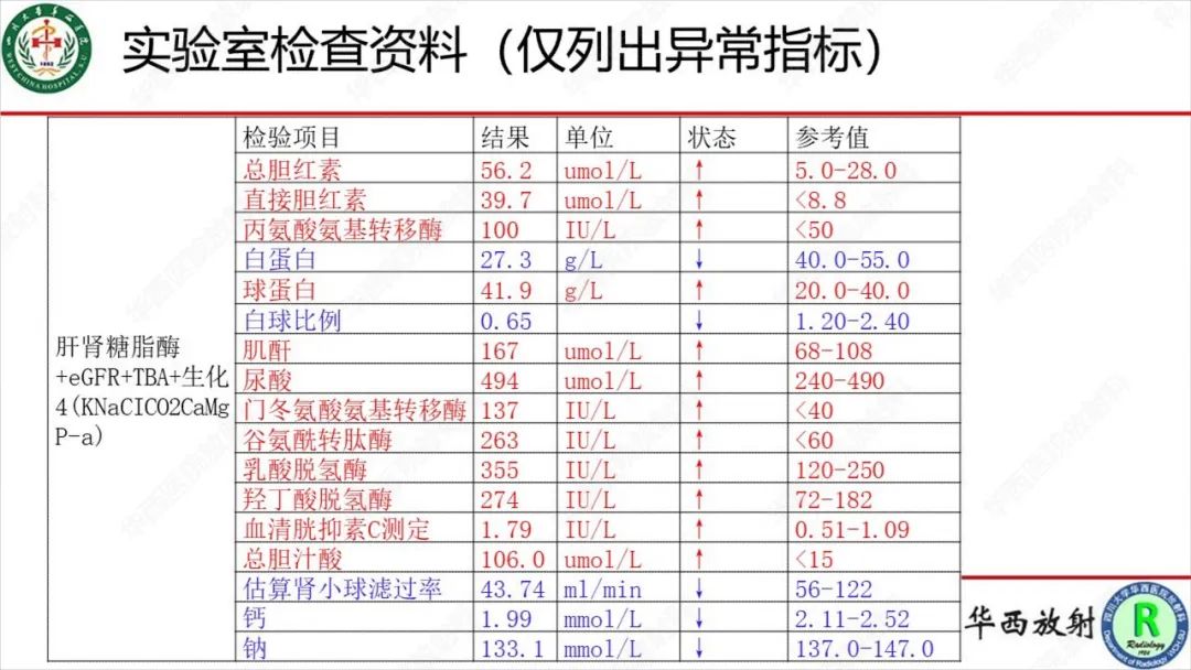 影像PPT - 【病例】肾脏滑膜肉瘤1例MR影像-3