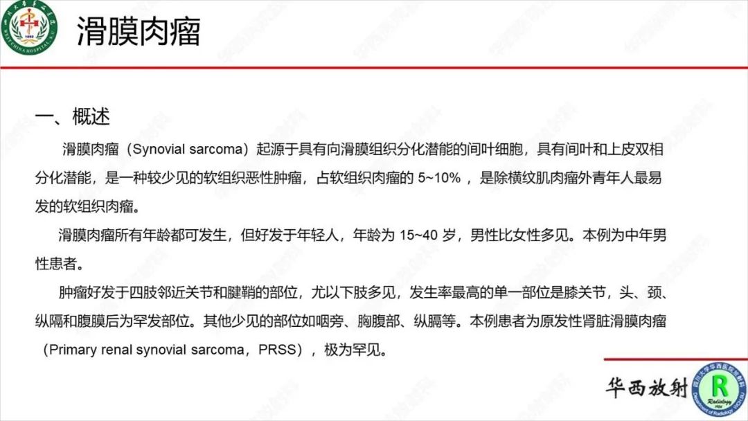影像PPT - 【病例】肾脏滑膜肉瘤1例MR影像-17