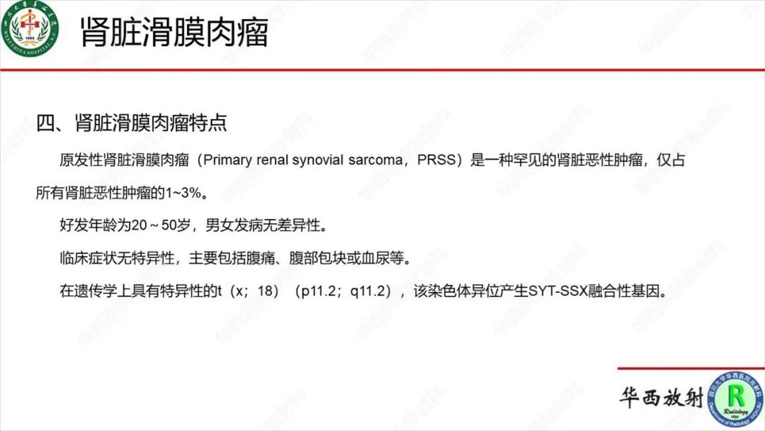 影像PPT - 【病例】肾脏滑膜肉瘤1例MR影像-19