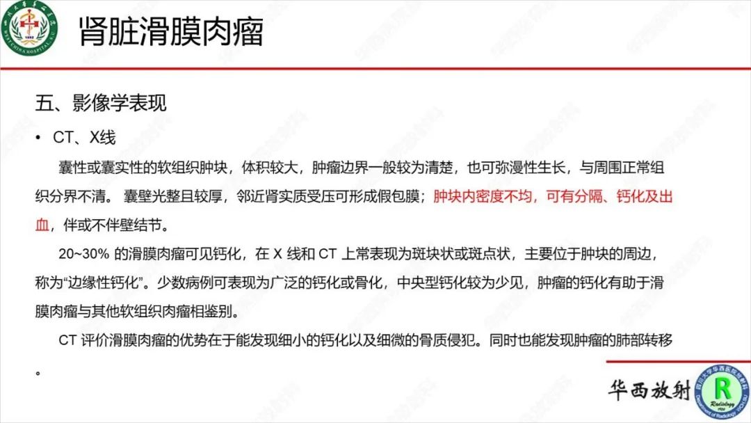 影像PPT - 【病例】肾脏滑膜肉瘤1例MR影像-20