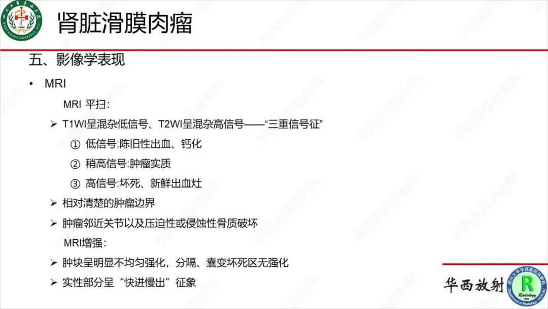 影像PPT - 【病例】肾脏滑膜肉瘤1例MR影像-21