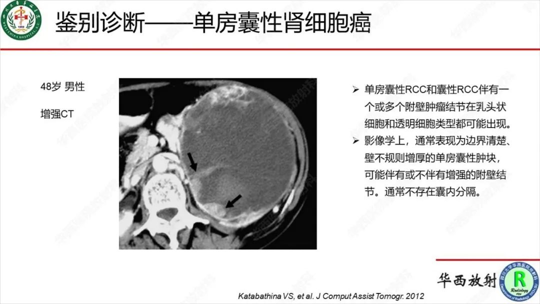 影像PPT - 【病例】肾脏滑膜肉瘤1例MR影像-24