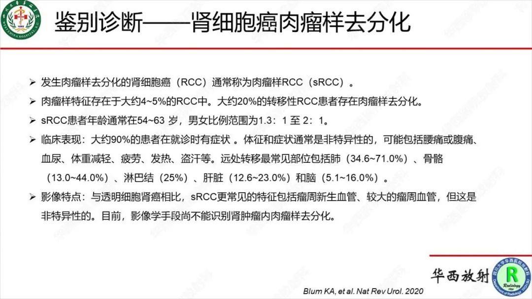 影像PPT - 【病例】肾脏滑膜肉瘤1例MR影像-28